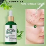 Uptown LA Anti Acne Serum Price in Pakistan | Best Acne & Pimple Removal Serum